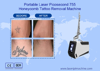 Dispositivo 755nm 1064nm 532nm de la máquina del retiro del tatuaje del laser del picosegundo del Nd Yag