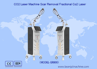 Máquina láser de CO2 vertical de eliminación de pigmentos de eliminación de cicatrices
