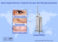 Laser de CO2 por radiofrecuencia fraccionada para la eliminación de cicatrices de las estrías Máquina de apretamiento vaginal