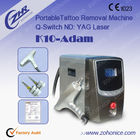 ND: La máquina del retiro del tatuaje del laser de YAG para quita la peca Y el pigmento de la edad, rojos