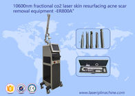 10600nm refrescan la máquina fraccionaria del laser del CO2 del haz para el retiro de la marca de estiramiento de la cicatriz del acné