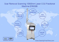 máquina fraccionaria del laser del CO2 10600nm para volver a allanar de la piel