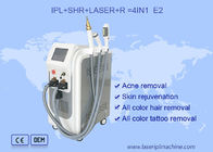 Máquina del laser IPL del ND YAG 530nm del retiro del acné