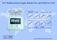 8 en 1 burbuja multifuncional del oxígeno de la máquina 110v de la belleza del cuidado de piel de Zohonice