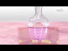 Del vacío portátil de la cavitación MLS05 las celulitis ultrasónicas del RF 40K reducen el dispositivo