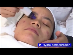 CV07 4IN1 Dispositivo de blanqueamiento facial de oxígeno para el rejuvenecimiento de fotones de succión facial