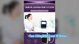 Líneas finas lisas no invasivas del cuidado de ojos 60W dispositivo llano multi de la radiofrecuencia