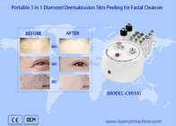 Máquina de limpieza portátil de 3in1 Diamond Dermabrasion Skin Peeling Facial