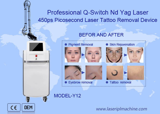 Máquina de extracción de tatuajes con láser de 755nm profesional Nd Yag Picosecond