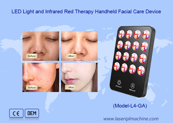 Dispositivo de luz LED de tratamiento de infrarrojos de mano para el cuidado facial y blanqueamiento de la piel
