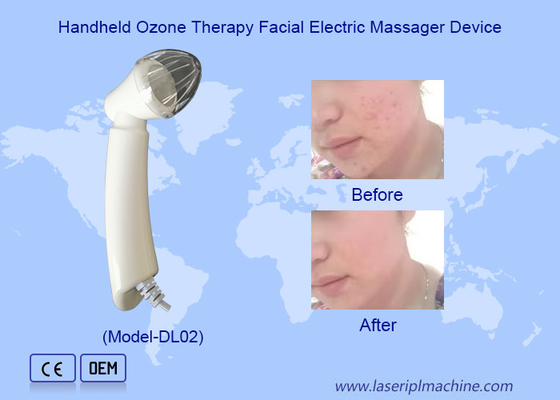 Dispositivo de masaje facial eléctrico de terapia de ozono portátil para la eliminación del acné de las arrugas
