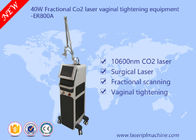 equipo fraccionario del laser del CO2 40w/equipo de ajuste vaginal comercial