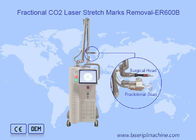Máquina fraccionaria del laser del CO2 de la exploración 10600nm 10x10m m del retiro de la cicatriz