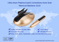 Máquina ultra micro del retiro de Pen Eyelids Corrections Acne Scar del plasma