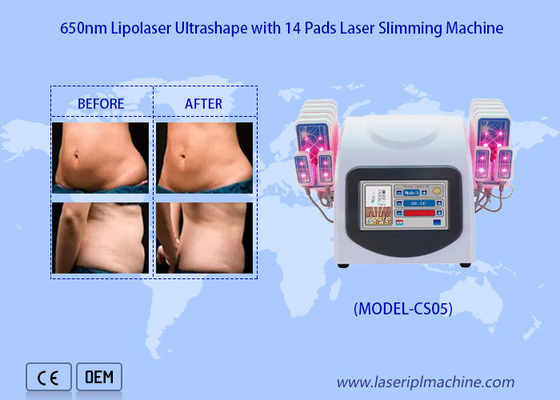el laser de 650nm Lipo rellena la máquina del Liposuction del laser para reduce retiro gordo de las celulitis