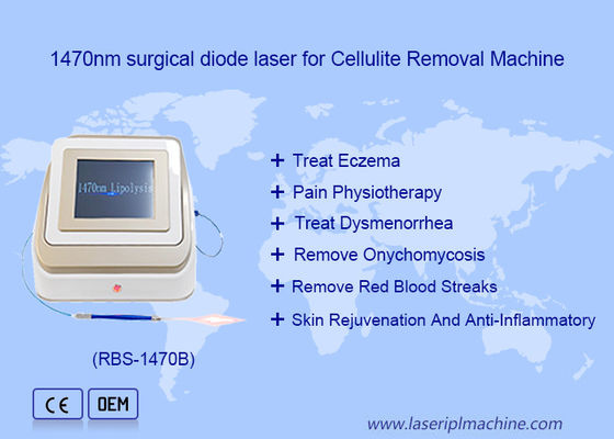 Buen precio 1470nm 980nm Diodo láser Lipólisis Cirugía Dispositivo láser Soluble en grasa en línea