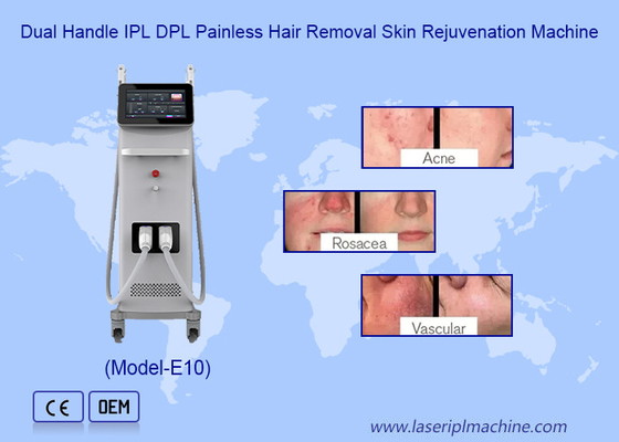Máquina profesional de depilación permanente IPL OPT para el rejuvenecimiento de la piel