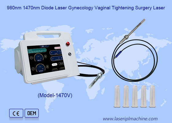 Láser de diodo de 980 nm 1470 nm  Ginecología  Vaginal  Estrechamiento  Cirugía Láser